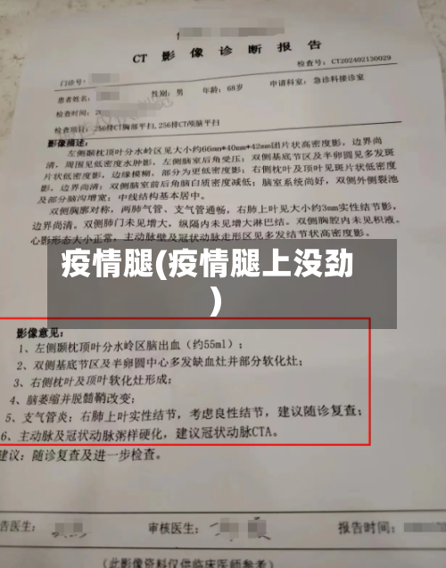 疫情腿(疫情腿上没劲)-第2张图片