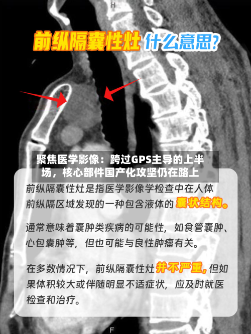 聚焦医学影像：跨过GPS主导的上半场，核心部件国产化攻坚仍在路上