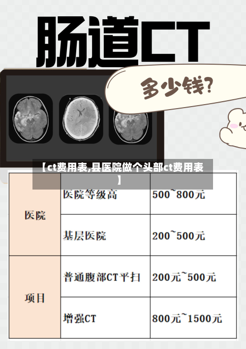 【ct费用表,县医院做个头部ct费用表】-第3张图片
