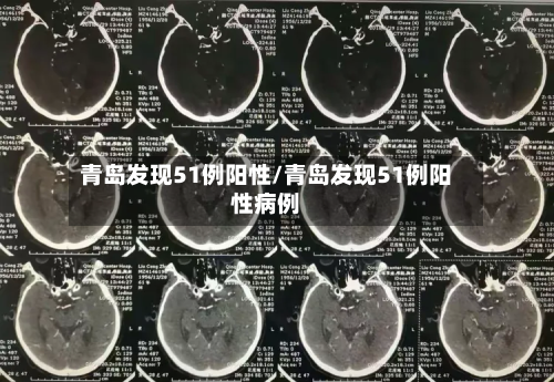 青岛发现51例阳性/青岛发现51例阳性病例-第2张图片
