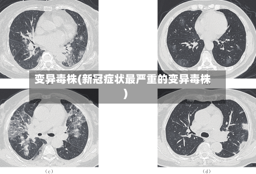 变异毒株(新冠症状最严重的变异毒株)