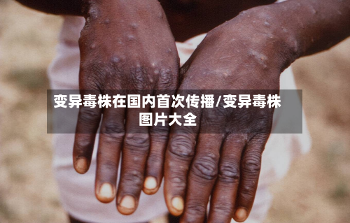 变异毒株在国内首次传播/变异毒株图片大全