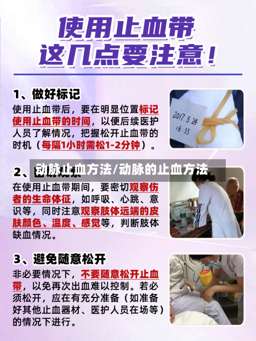 动脉止血方法/动脉的止血方法