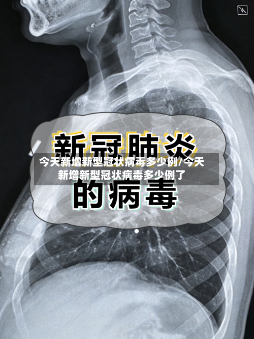 今天新增新型冠状病毒多少例/今天新增新型冠状病毒多少例了