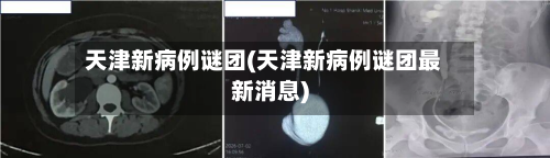 天津新病例谜团(天津新病例谜团最新消息)