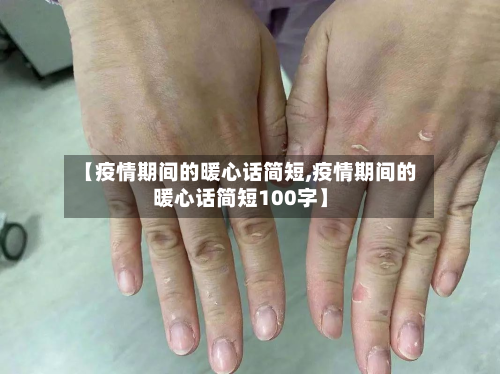 【疫情期间的暖心话简短,疫情期间的暖心话简短100字】-第3张图片