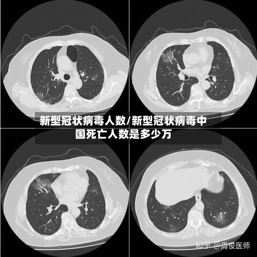 新型冠状病毒人数/新型冠状病毒中国死亡人数是多少万